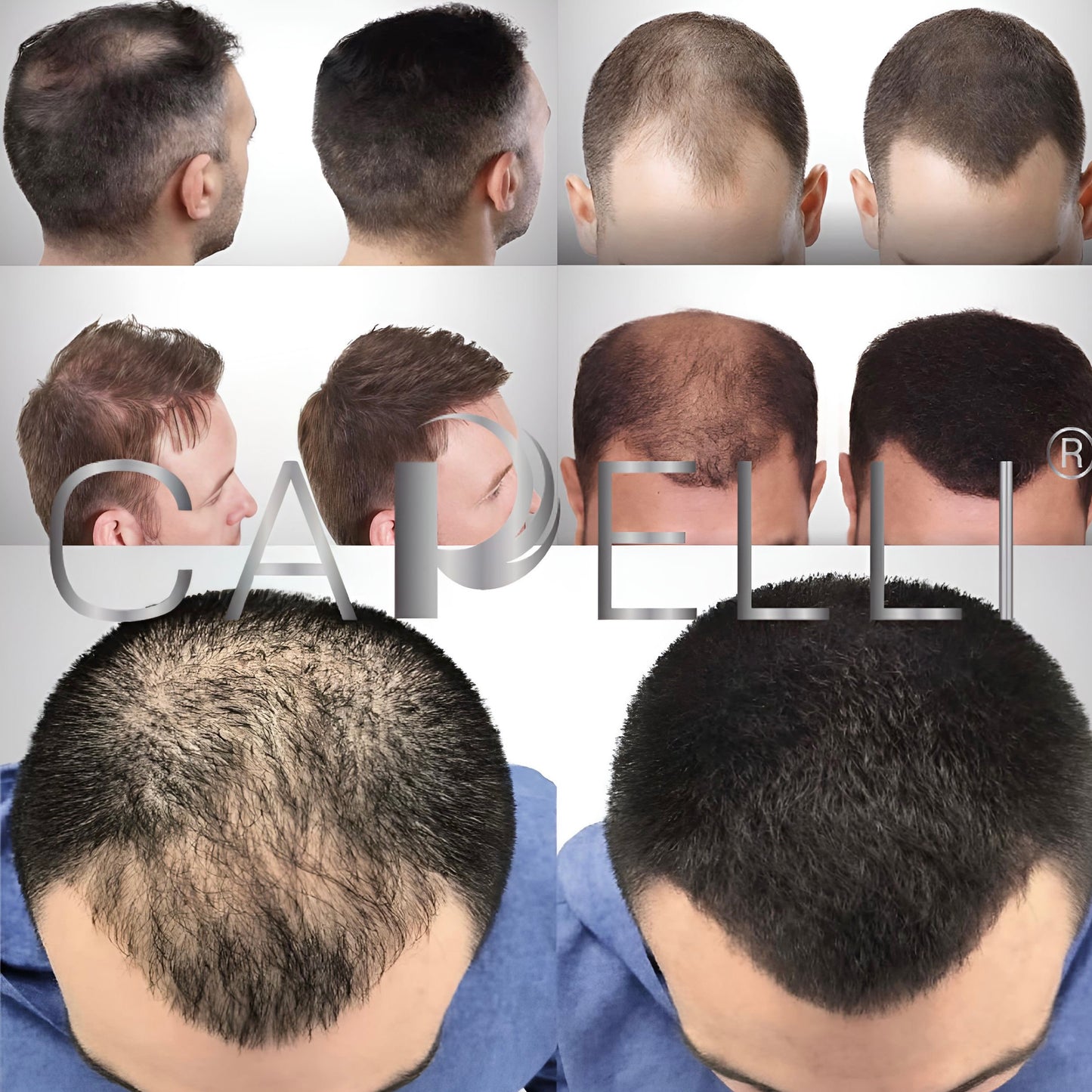 3 CAPELLI® 15 gr.